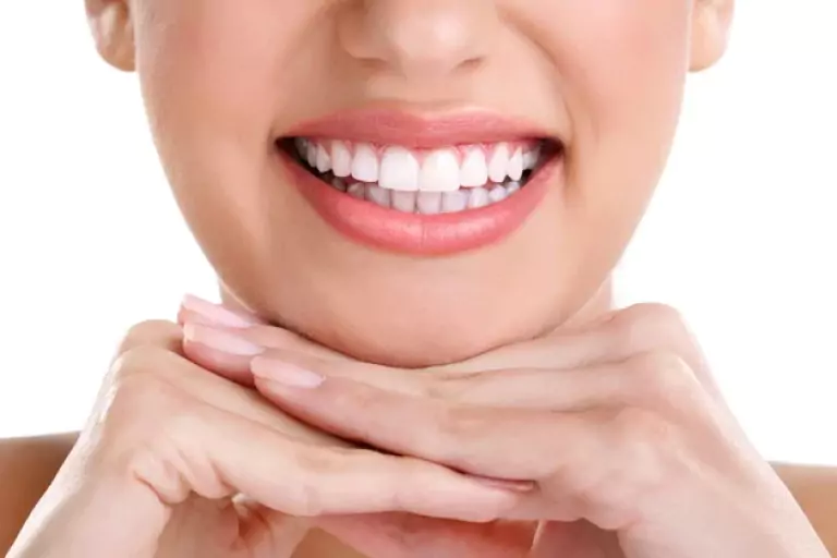 Bright white smile result from professional teeth whitening